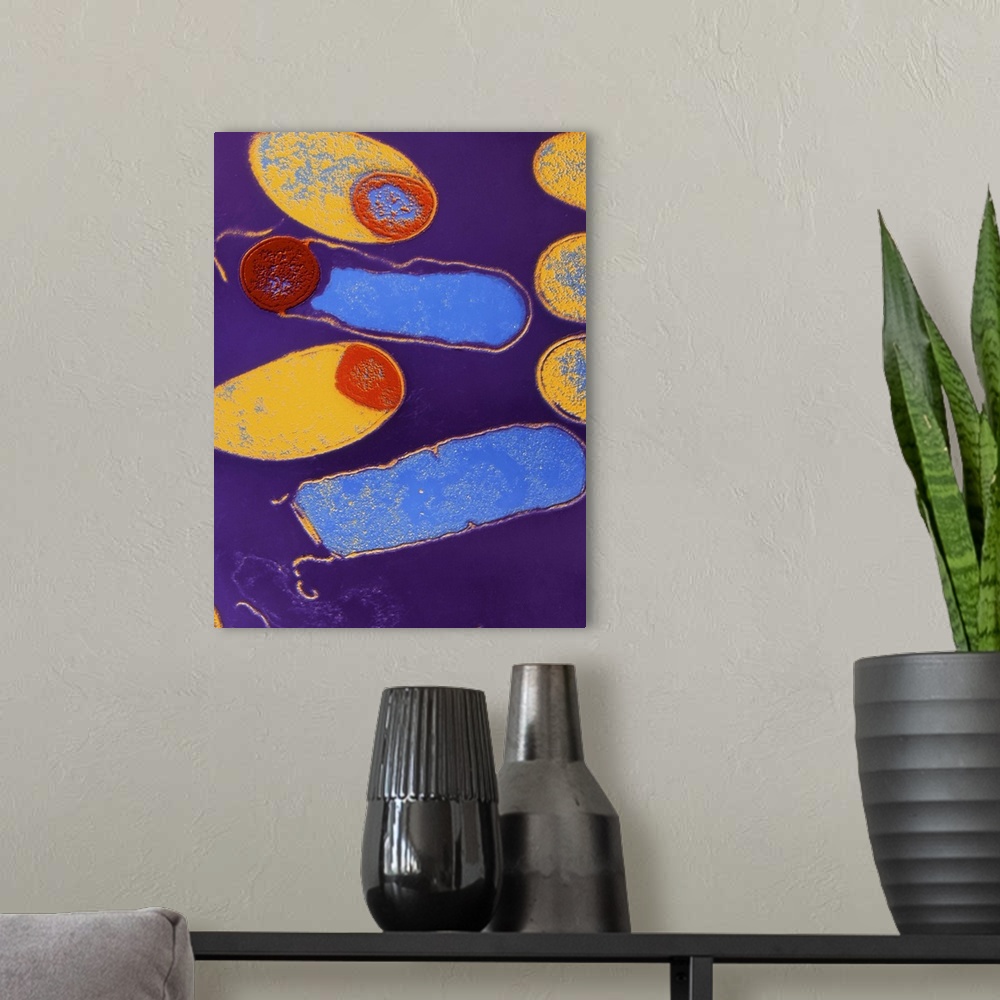 A modern room featuring Coloured transmission electron micrograph (TEM) of the bacteria Clostridium botulinum, cause of b...