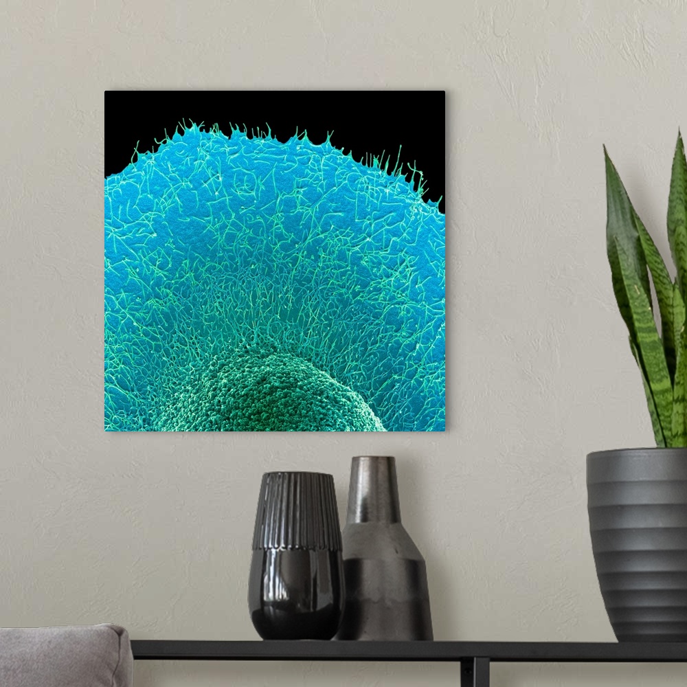 A modern room featuring Colorectal cancer cell. Coloured scanning electron micrograph (SEM) of part of a cancer cell from...