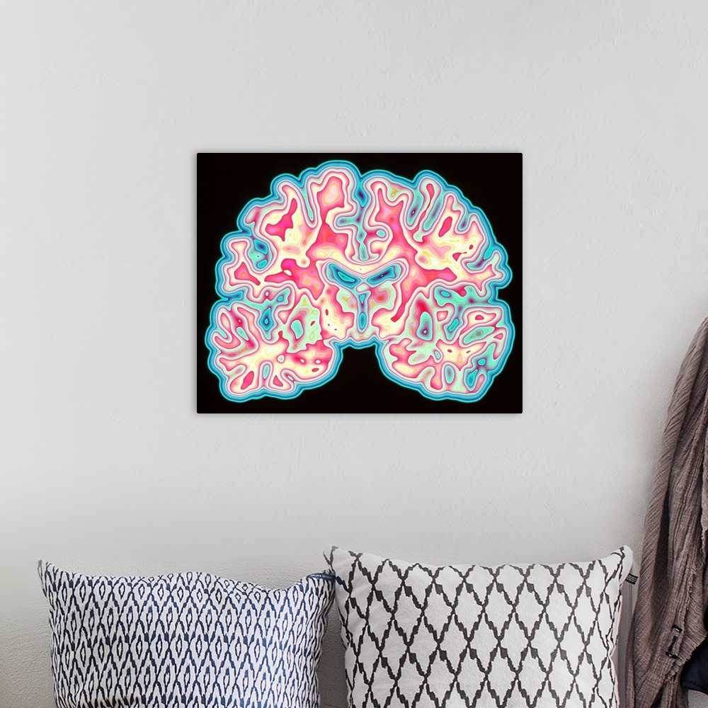 A bohemian room featuring Brain. Coloured computed tomography (CT) scan of a section through a healthy human brain. The hea...