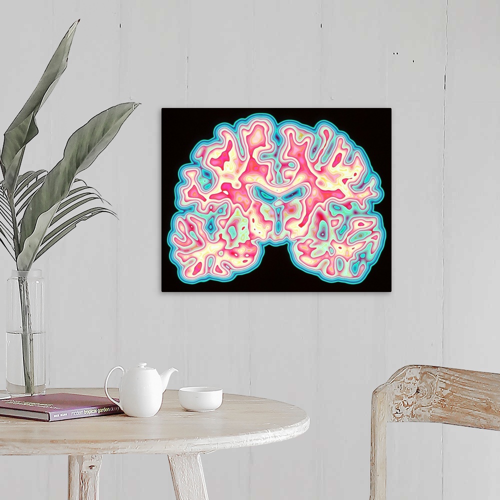 A farmhouse room featuring Brain. Coloured computed tomography (CT) scan of a section through a healthy human brain. The hea...