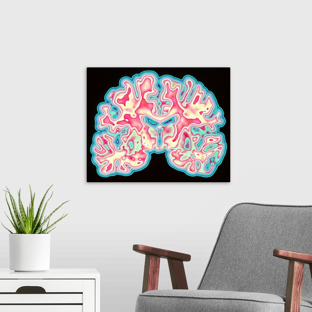 A modern room featuring Brain. Coloured computed tomography (CT) scan of a section through a healthy human brain. The hea...