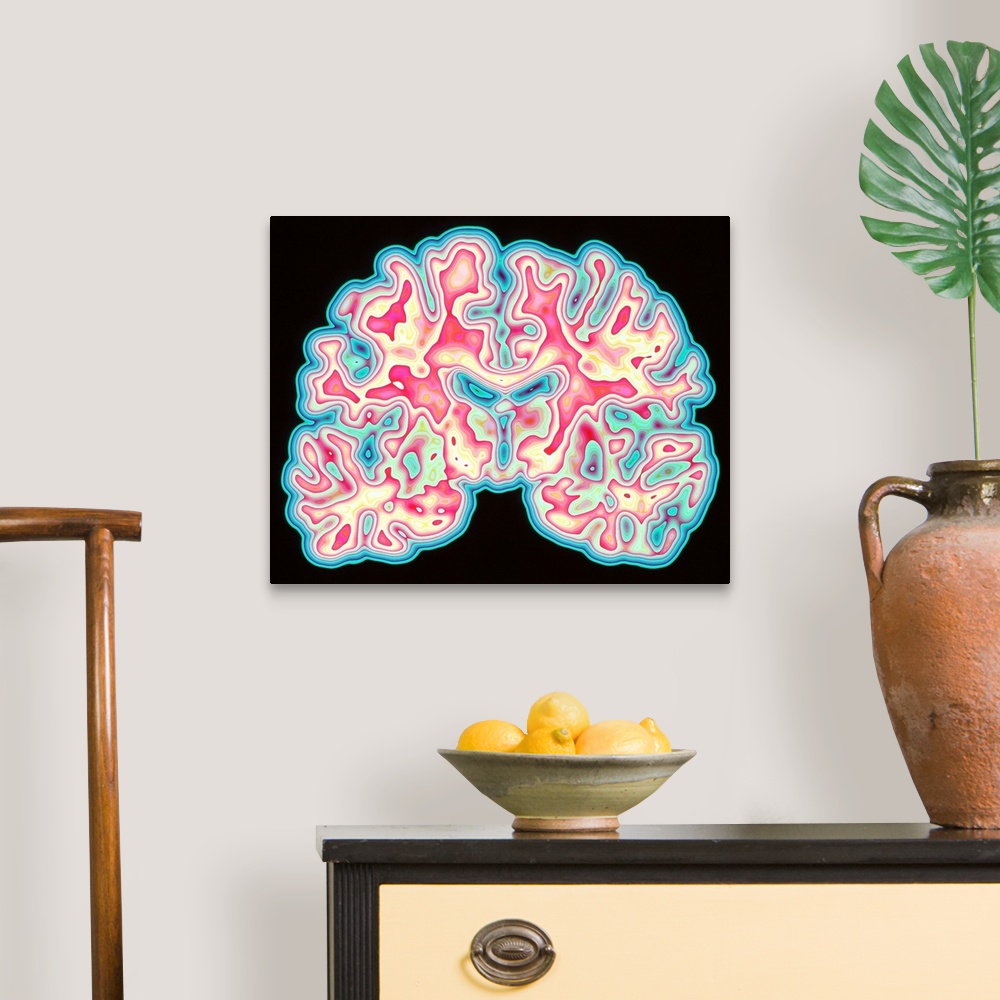 A traditional room featuring Brain. Coloured computed tomography (CT) scan of a section through a healthy human brain. The hea...