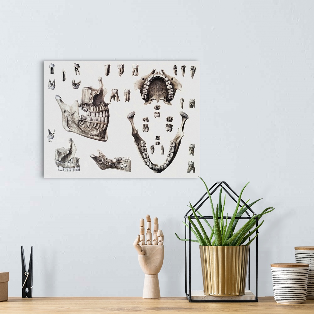 A bohemian room featuring Dental anatomy. Historical anatomical artwork of healthy and diseased human teeth and jaws. The t...