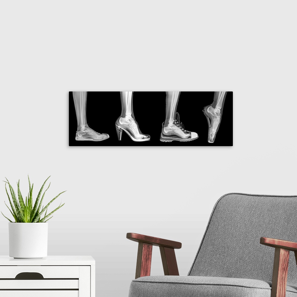 A modern room featuring X-ray of a woman's foot in 4 different shoes (from left to right) Trainers, High Heel, Running an...