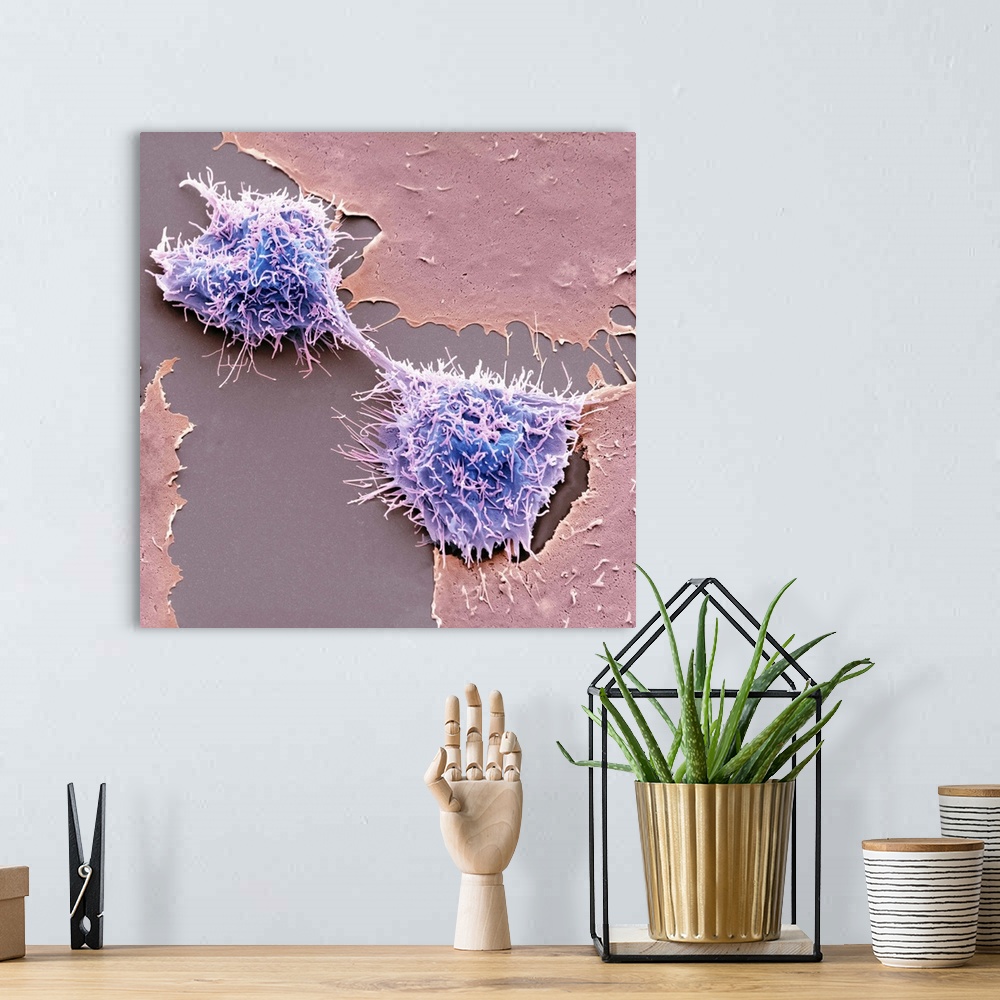 A bohemian room featuring Dividing HeLa cells. Coloured scanning electron micrograph (SEM) of HeLa cells undergoing cytokin...