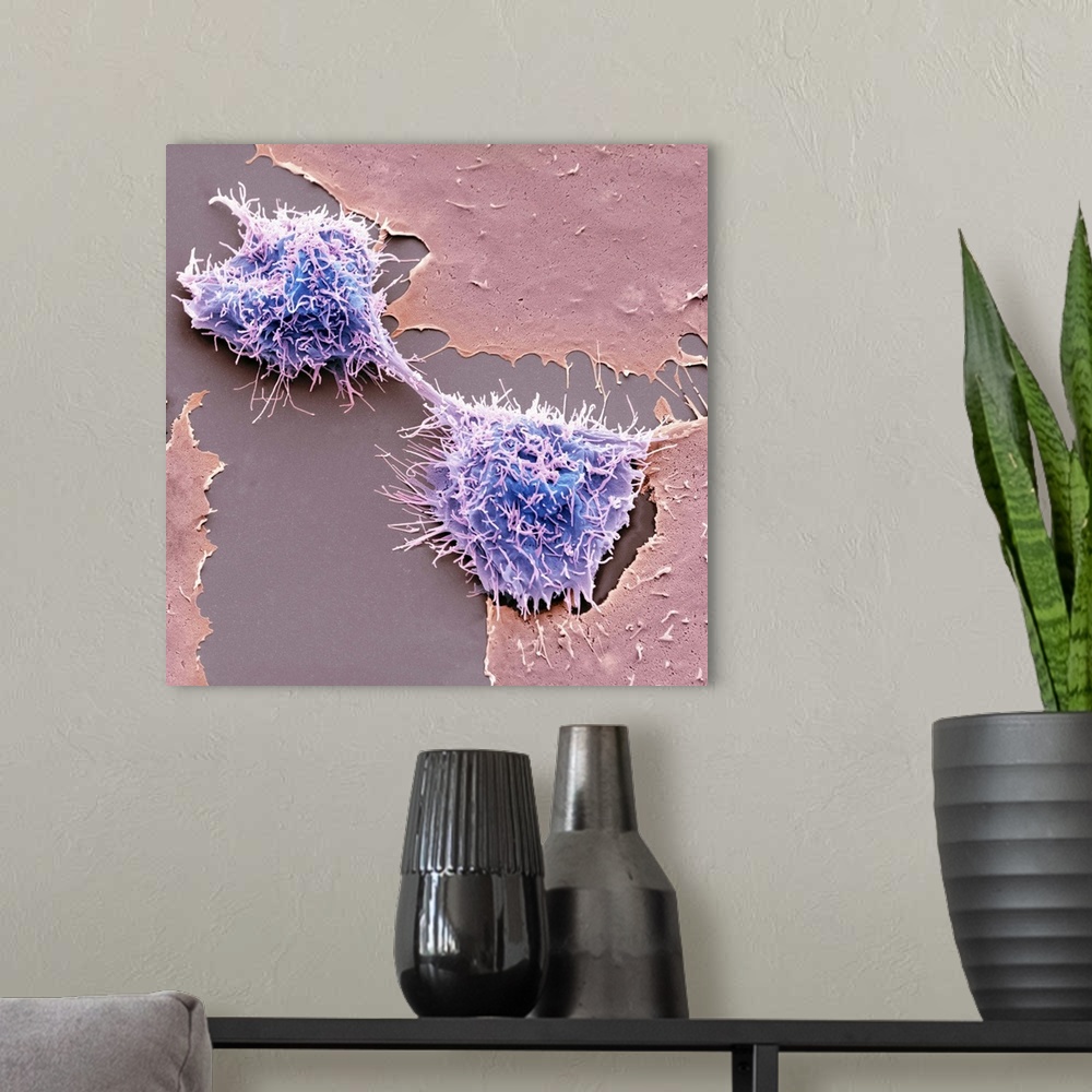 A modern room featuring Dividing HeLa cells. Coloured scanning electron micrograph (SEM) of HeLa cells undergoing cytokin...