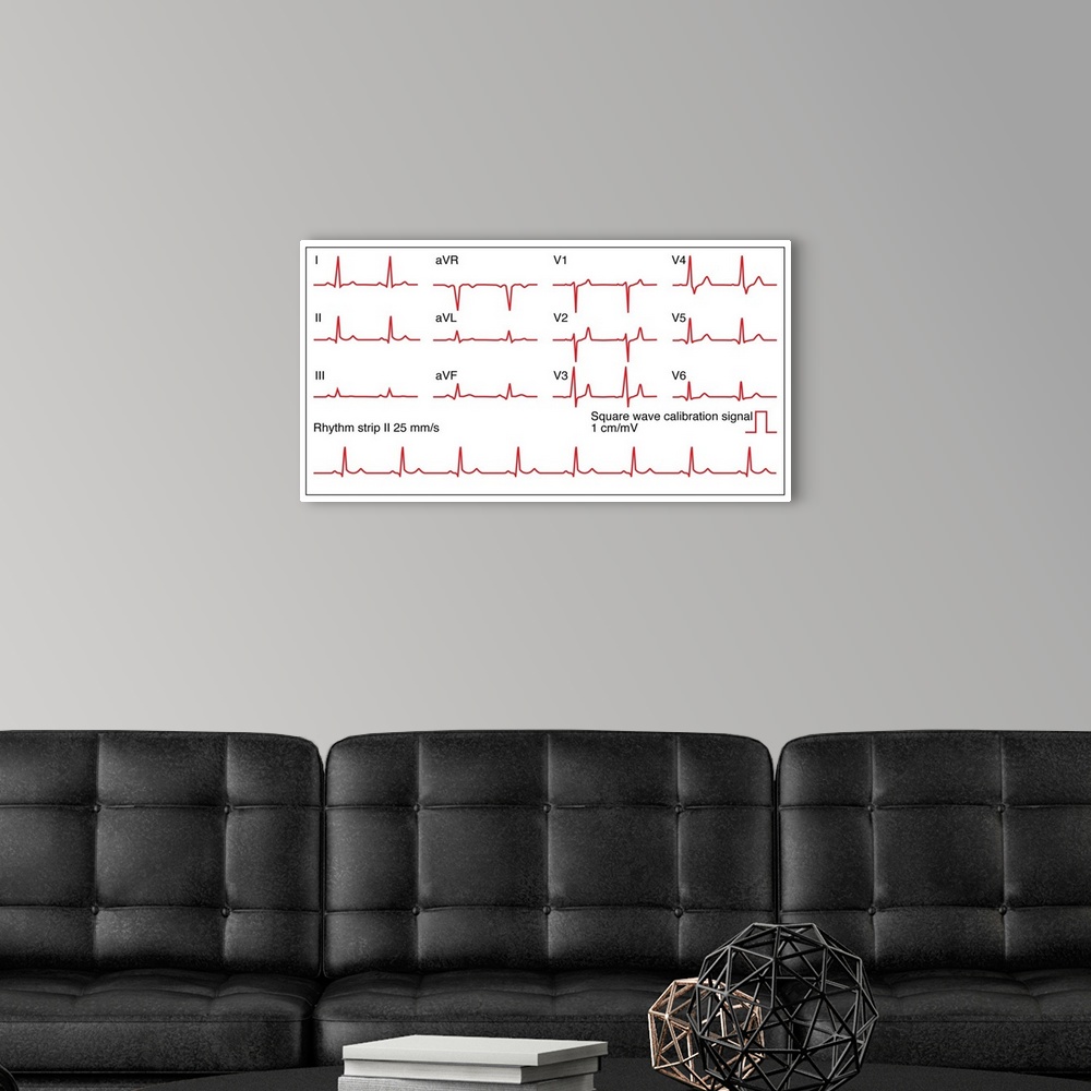 A modern room featuring Electrocardiograms (ECG) of a normal heart rate, artwork. An ECG measures the electrical activity...