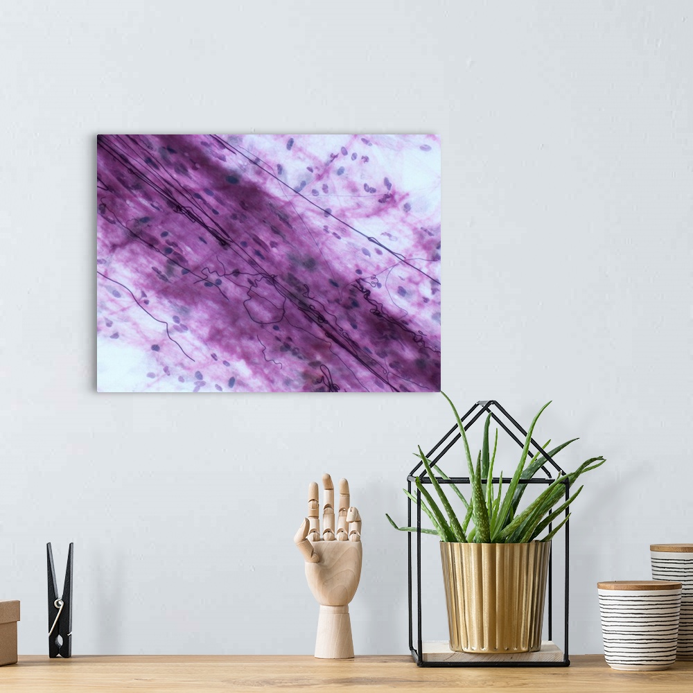 A bohemian room featuring Light micrograph (LM) of loose connective tissue to show elastin fibers. Elastin fibres form a 3D...