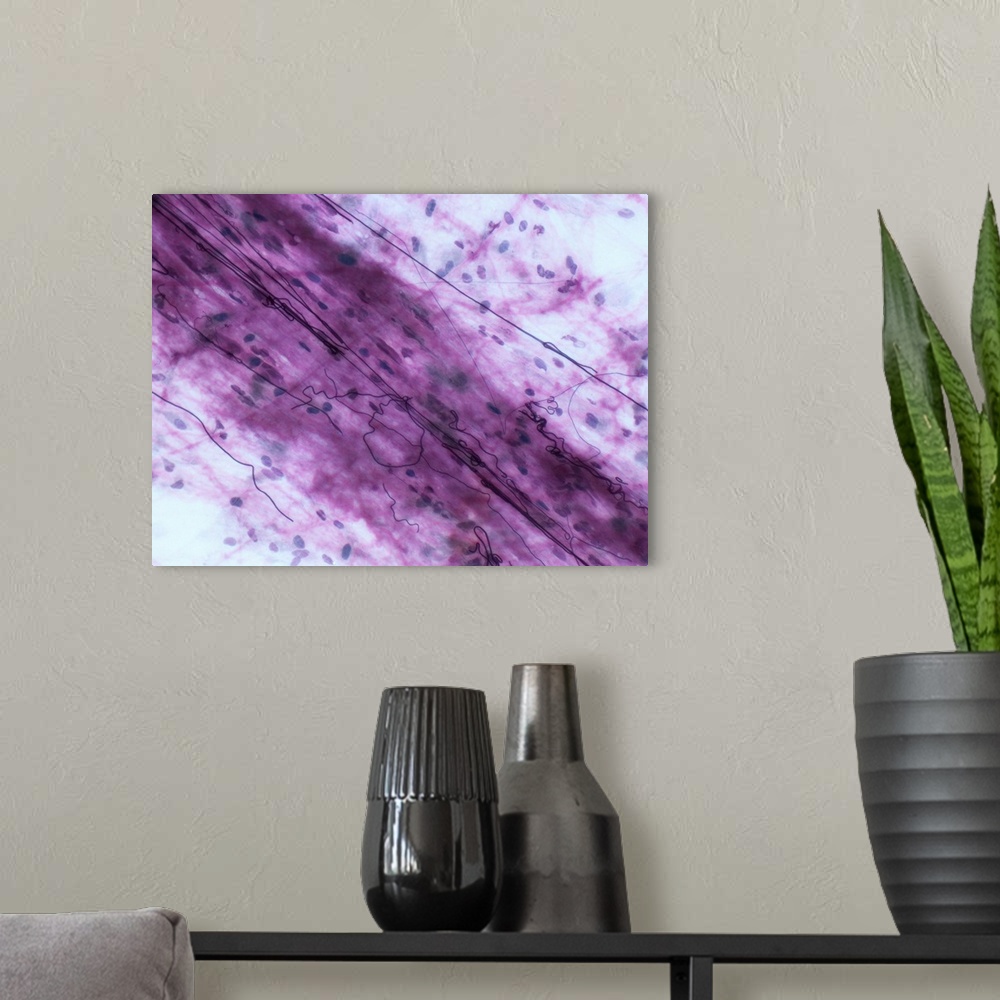 A modern room featuring Light micrograph (LM) of loose connective tissue to show elastin fibers. Elastin fibres form a 3D...