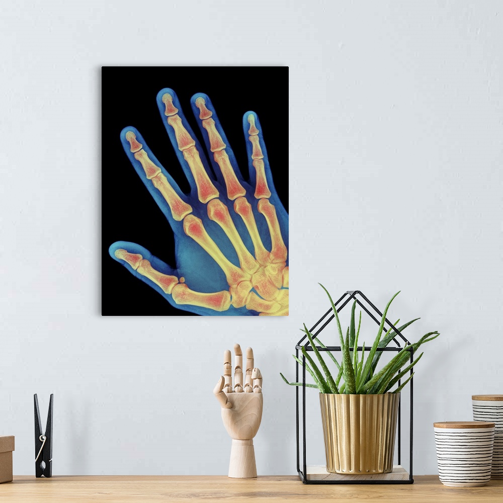 A bohemian room featuring Healthy hand. Coloured X-ray of the healthy hand of a 60 year old man, showing the skeleton of bo...