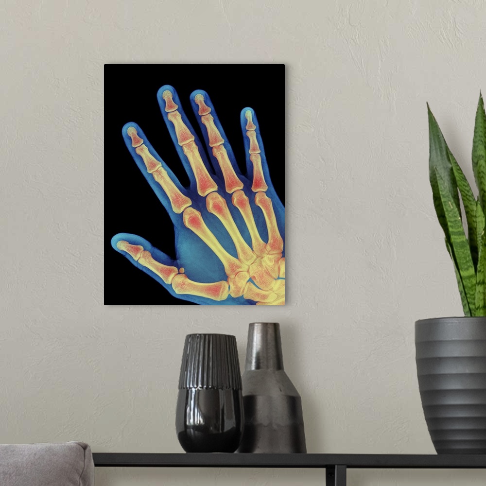 A modern room featuring Healthy hand. Coloured X-ray of the healthy hand of a 60 year old man, showing the skeleton of bo...