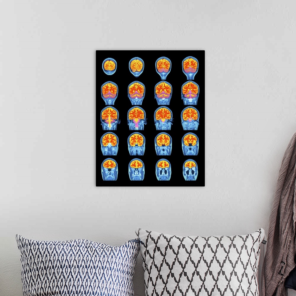 A bohemian room featuring Healthy brain. Coloured magnetic resonance imaging (MRI) scans through the head of a 31 year old ...