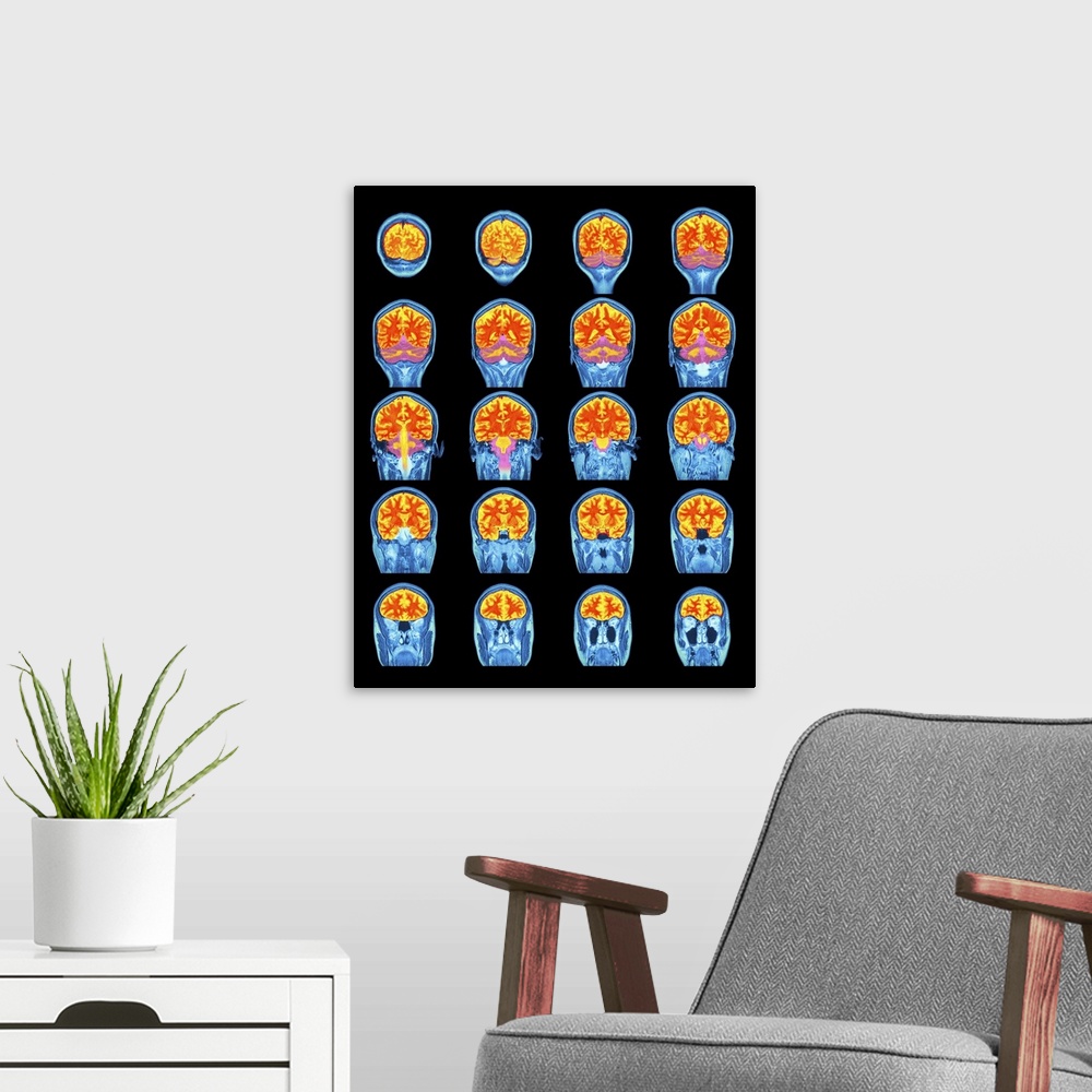 A modern room featuring Healthy brain. Coloured magnetic resonance imaging (MRI) scans through the head of a 31 year old ...