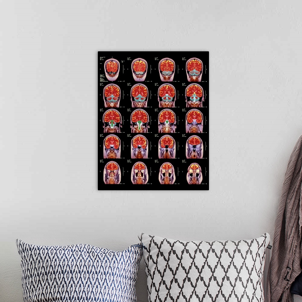 A bohemian room featuring Healthy brain. Coloured magnetic resonance imaging (MRI) scans through the head of a 55 year old ...