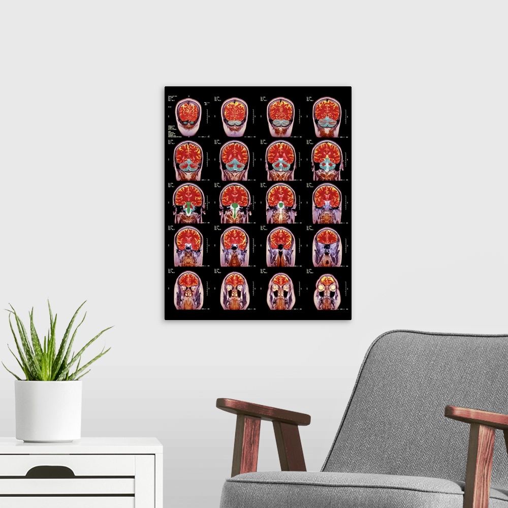 A modern room featuring Healthy brain. Coloured magnetic resonance imaging (MRI) scans through the head of a 55 year old ...