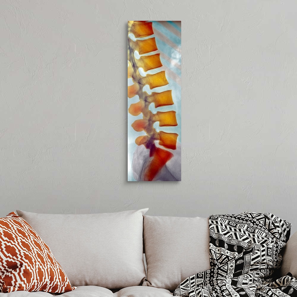 A bohemian room featuring Healthy spine. Coloured X-ray of a side view of the healthy lower (lumbar) spine of an adult man....