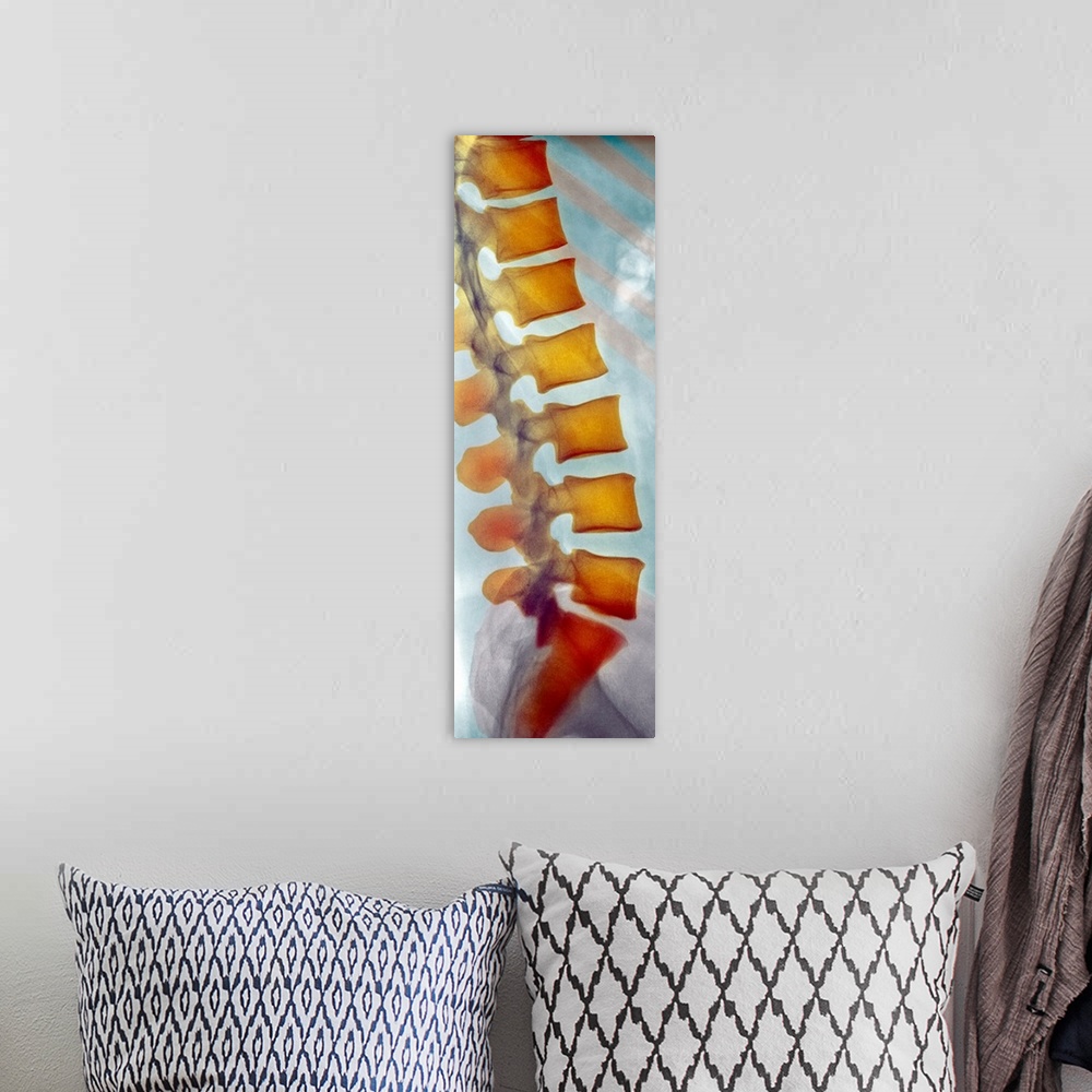 A bohemian room featuring Healthy spine. Coloured X-ray of a side view of the healthy lower (lumbar) spine of an adult man....