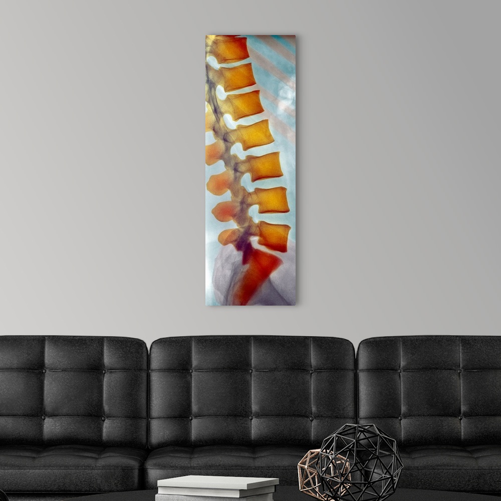 A modern room featuring Healthy spine. Coloured X-ray of a side view of the healthy lower (lumbar) spine of an adult man....