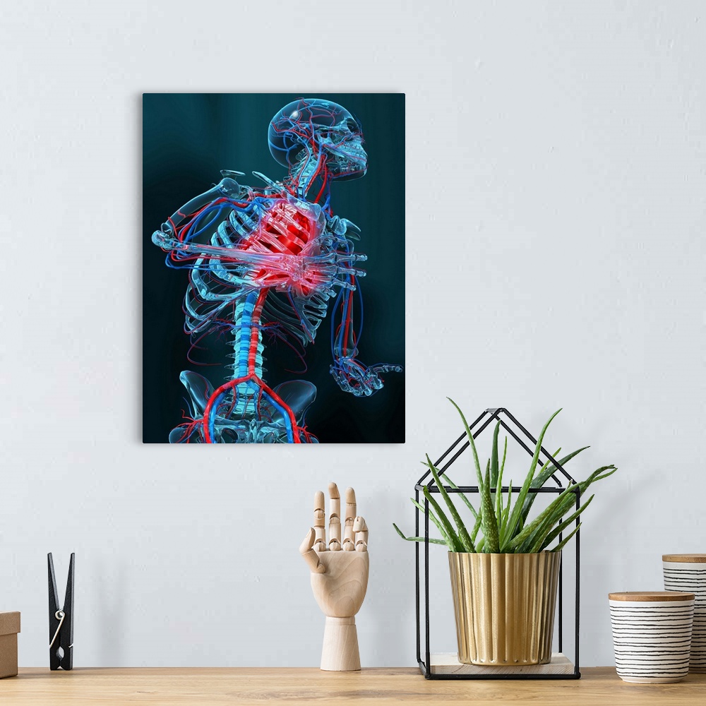 A bohemian room featuring Heart attack. Computer artwork of the head and body of a human skeleton that is having a heart at...