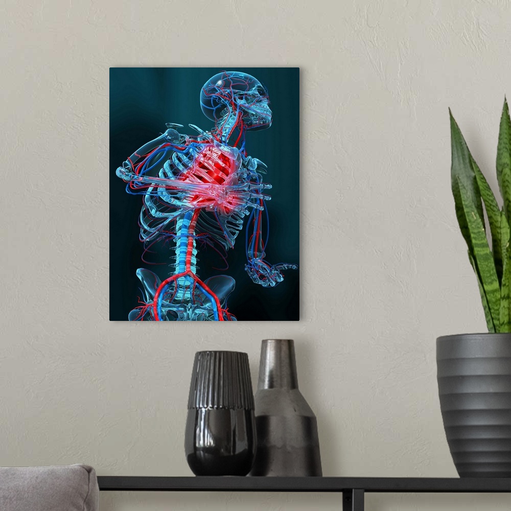 A modern room featuring Heart attack. Computer artwork of the head and body of a human skeleton that is having a heart at...