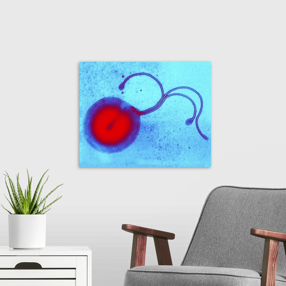 A modern room featuring Helicobacter pylori bacterium, coloured transmission electron micrograph (TEM). This section thro...