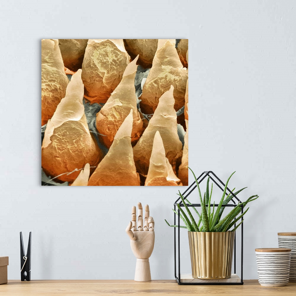A bohemian room featuring Human tongue surface, coloured scanning electron micrograph (SEM). The tongue is covered in many ...