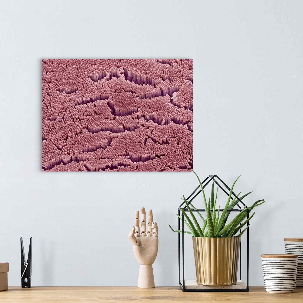 A bohemian room featuring Intestinal microvilli. Coloured scanning electron micrograph (SEM) of microvilli from the small i...