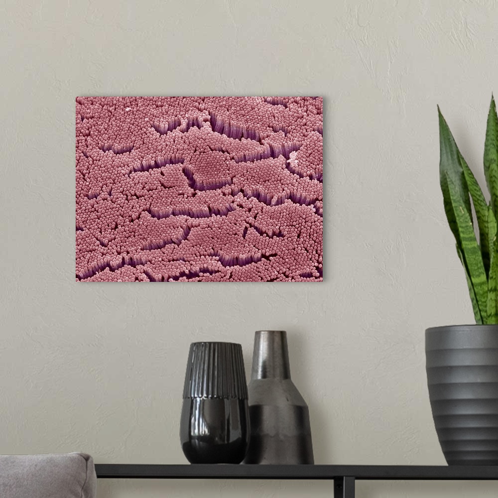 A modern room featuring Intestinal microvilli. Coloured scanning electron micrograph (SEM) of microvilli from the small i...