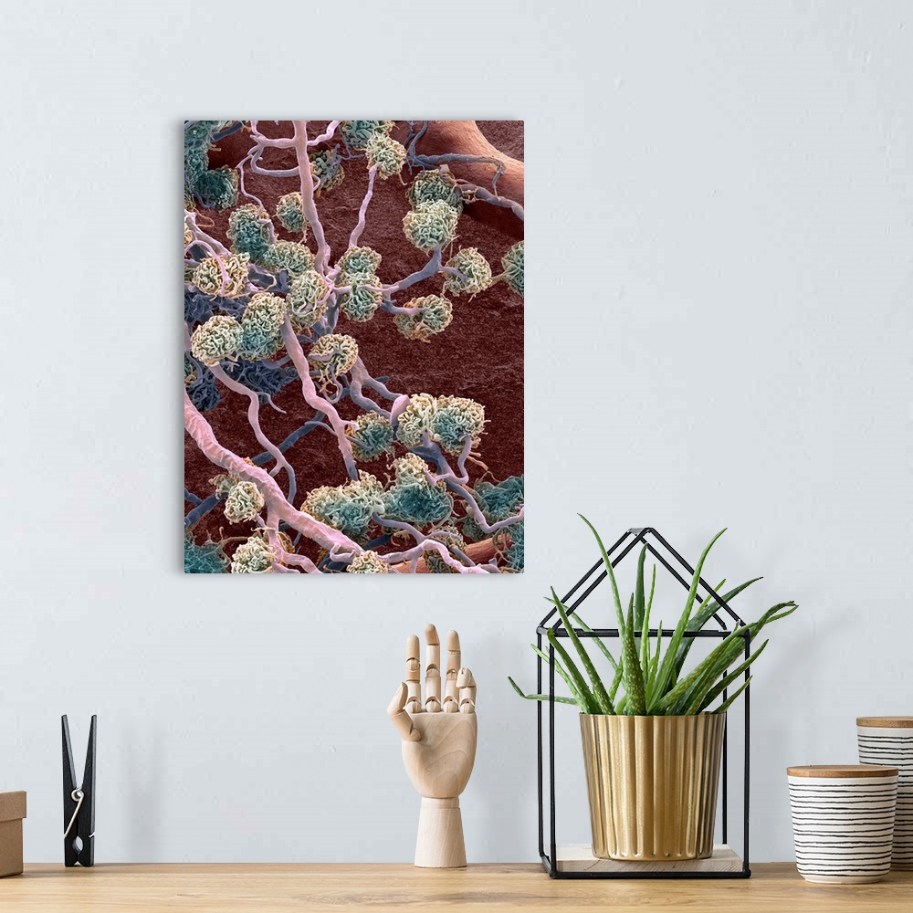 A bohemian room featuring Kidney glomeruli, coloured scanning electron micrograph (SEM). The cells that usually surround th...