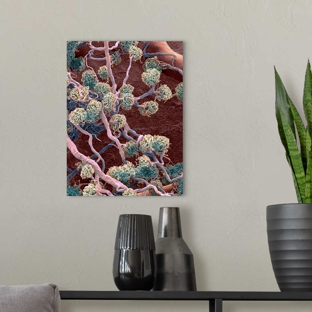 A modern room featuring Kidney glomeruli, coloured scanning electron micrograph (SEM). The cells that usually surround th...