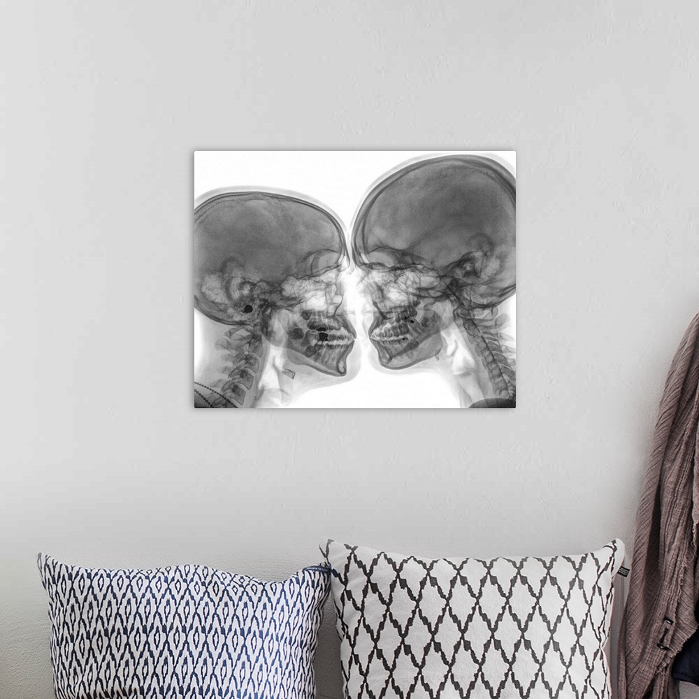 A bohemian room featuring Kissing Couple. Two people kissing under x-ray