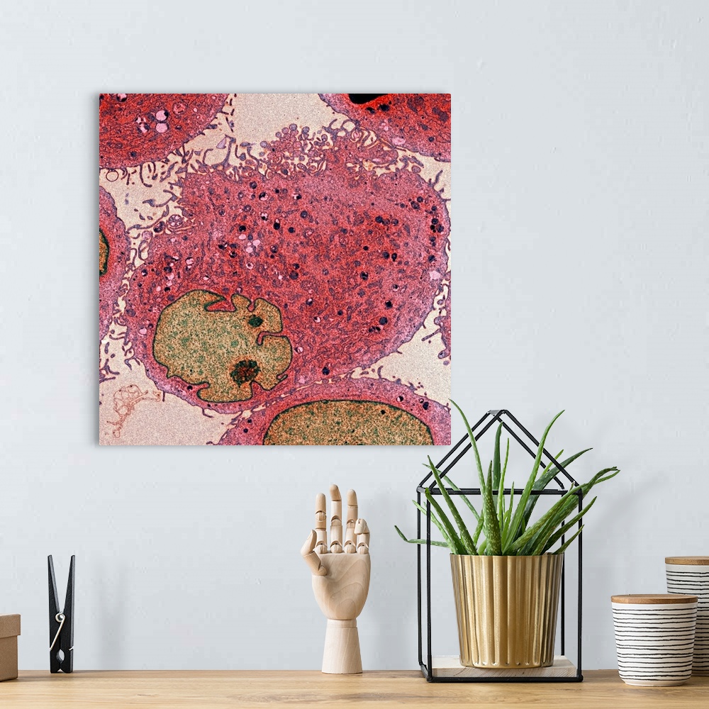 A bohemian room featuring Leukaemia cells in a patient with Bloom's syndrome, coloured transmission electron micrograph (TE...