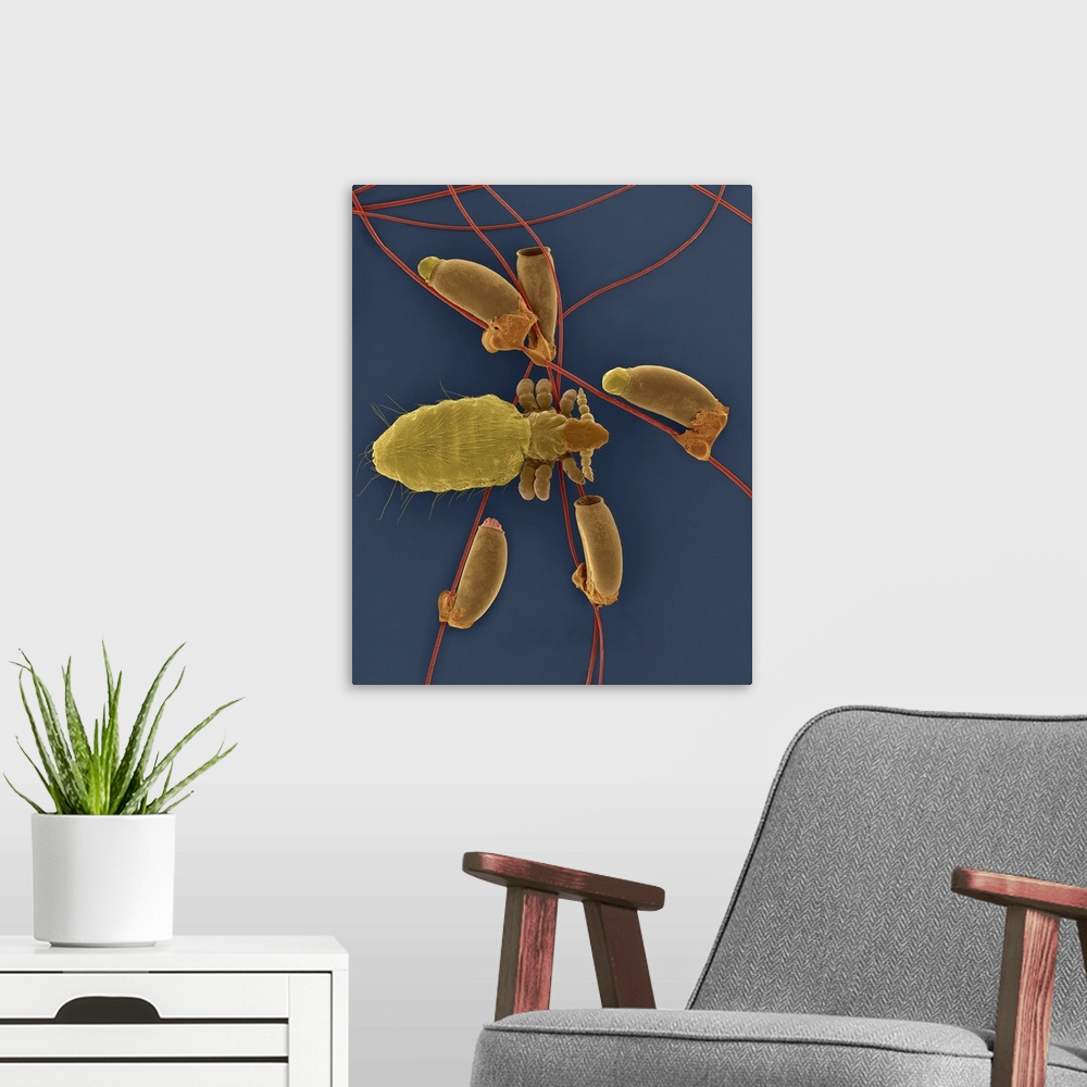 A modern room featuring Coloured scanning electron micrograph (SEM) of Long-nosed cattle louse (Linognathus vituli) and e...
