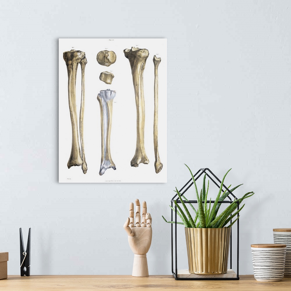 A bohemian room featuring Lower leg bones and ligaments. Historical anatomical artwork of lower leg bones (yellow) and liga...