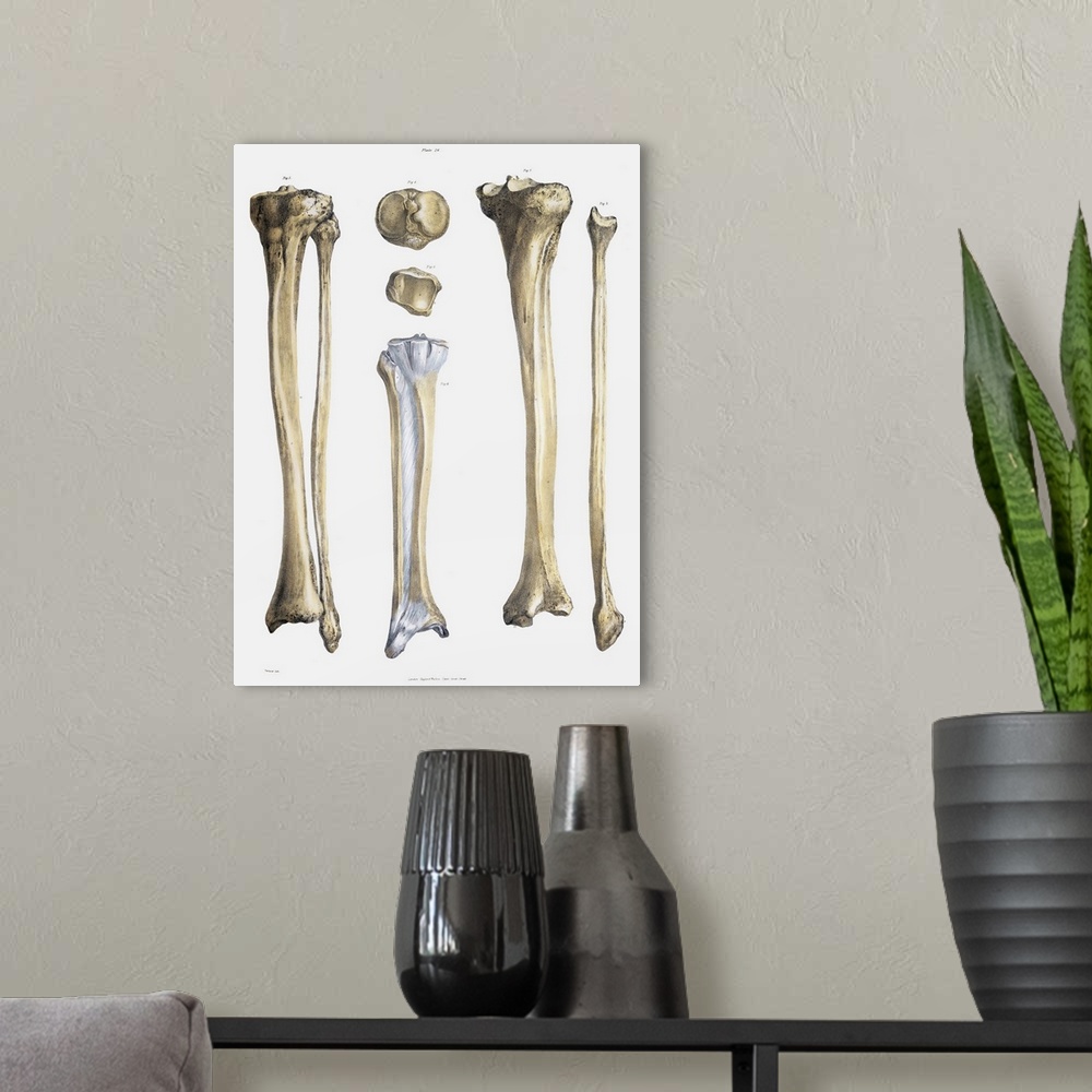 A modern room featuring Lower leg bones and ligaments. Historical anatomical artwork of lower leg bones (yellow) and liga...