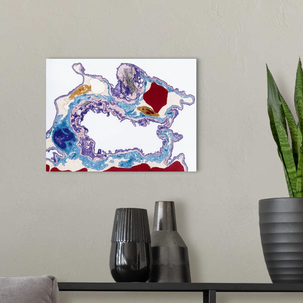 A modern room featuring Lung tissue, coloured transmission electron micrograph (TEM). A single alveolus is at center. At ...