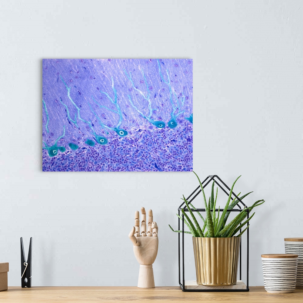 A bohemian room featuring Nerve cells. Light micrograph of Purkinje neurons (nerve cells, blue) in the cerebellum. These ce...