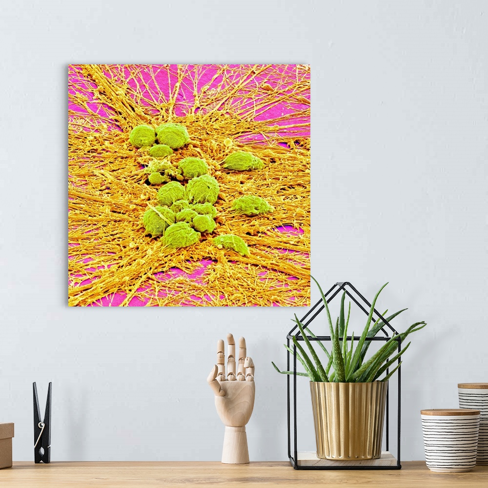 A bohemian room featuring Nervous system cells. Coloured scanning electron micrograph (SEM) of neurons (nerve cells, green)...