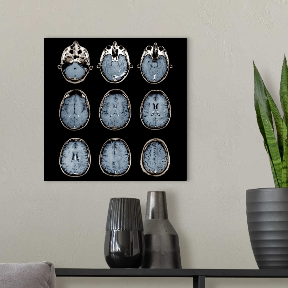 A modern room featuring Normal brain. Coloured magnetic resonance imaging (MRI) scans of axial sections through the healt...