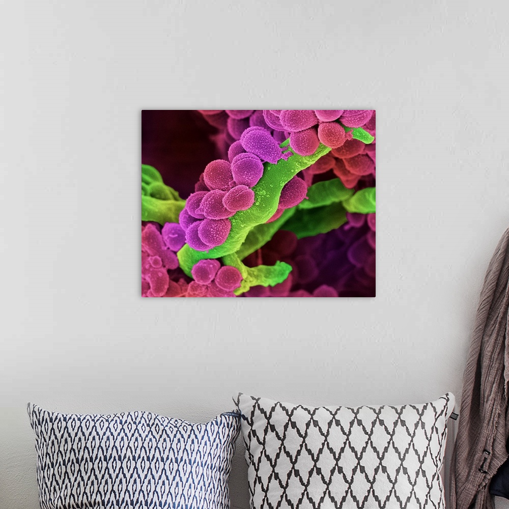 A bohemian room featuring Oral Streptococcus bacteria. Coloured scanning electron micrograph (SEM) of chains of Streptococc...