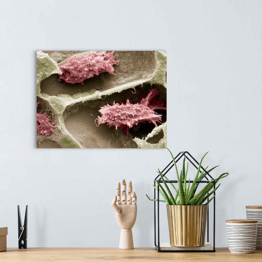 A bohemian room featuring Osteoclasts in bone lacunae, coloured scanning electron micrograph (SEM). These osteoclasts are s...