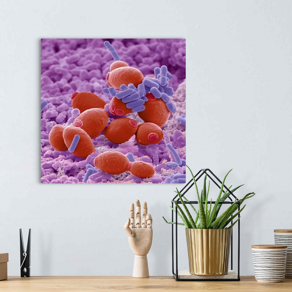 A bohemian room featuring Probiotic flora, scanning electron micrograph (SEM). Probiotics are defined as live microorganism...
