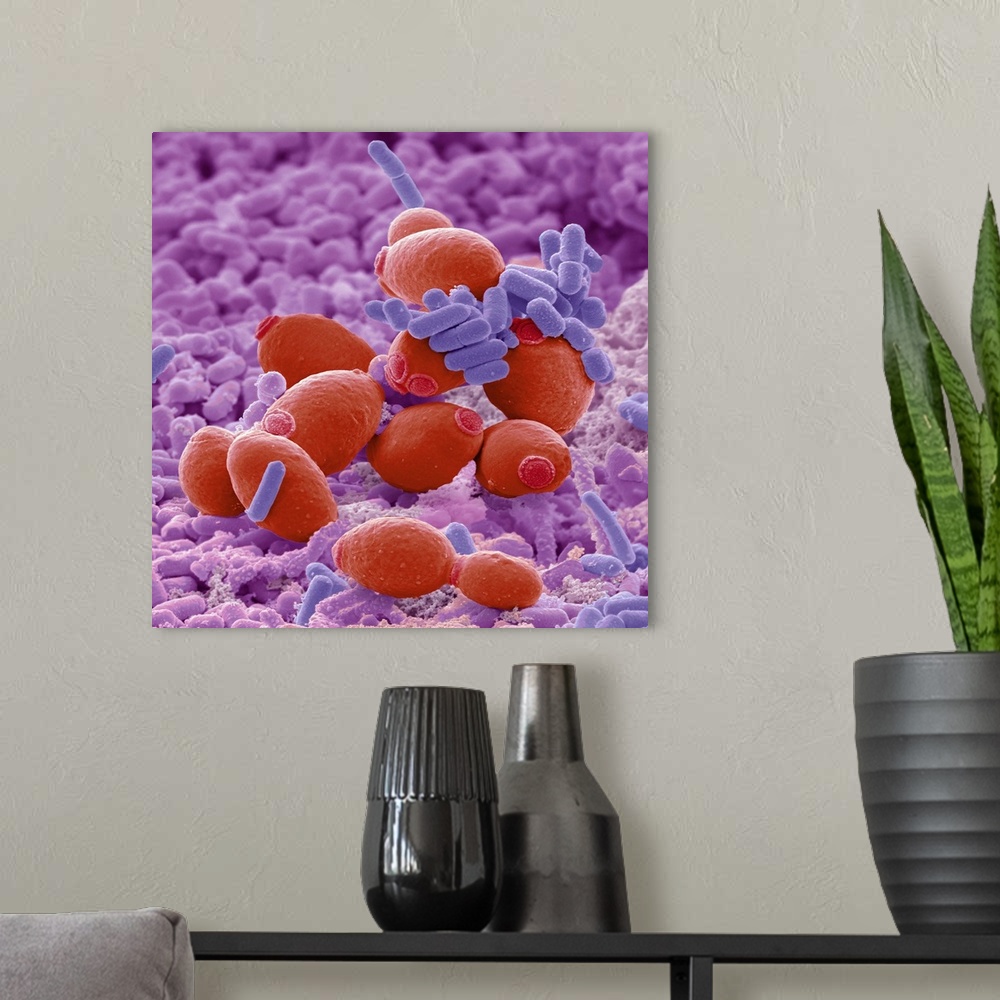 A modern room featuring Probiotic flora, scanning electron micrograph (SEM). Probiotics are defined as live microorganism...