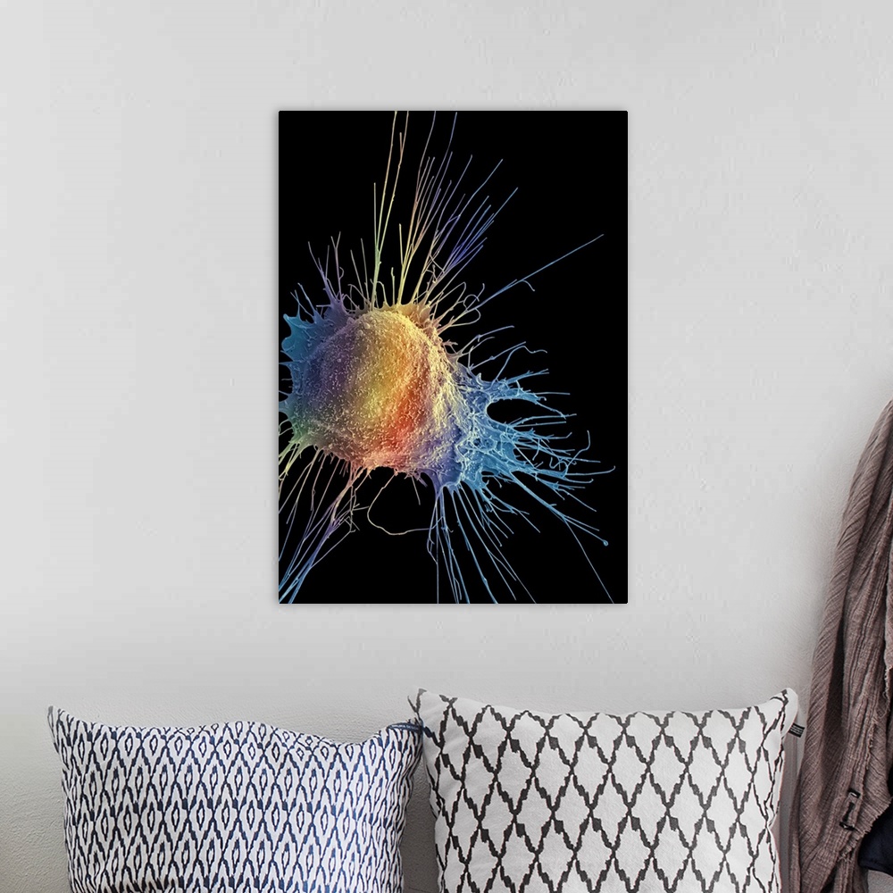 A bohemian room featuring Prostate cancer cell, Coloured scanning electron micrograph (SEM). Such cells can clump to form t...