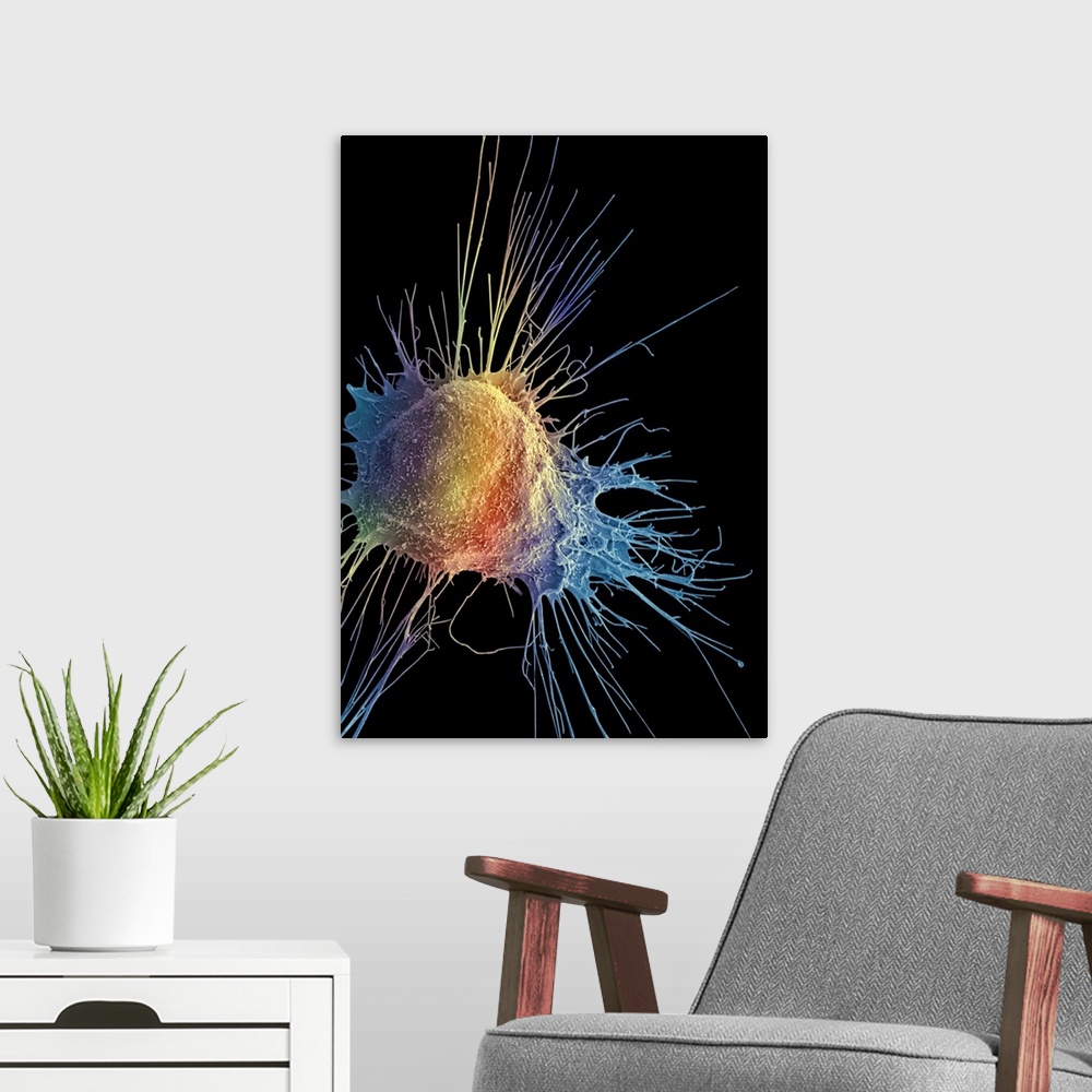 A modern room featuring Prostate cancer cell, Coloured scanning electron micrograph (SEM). Such cells can clump to form t...
