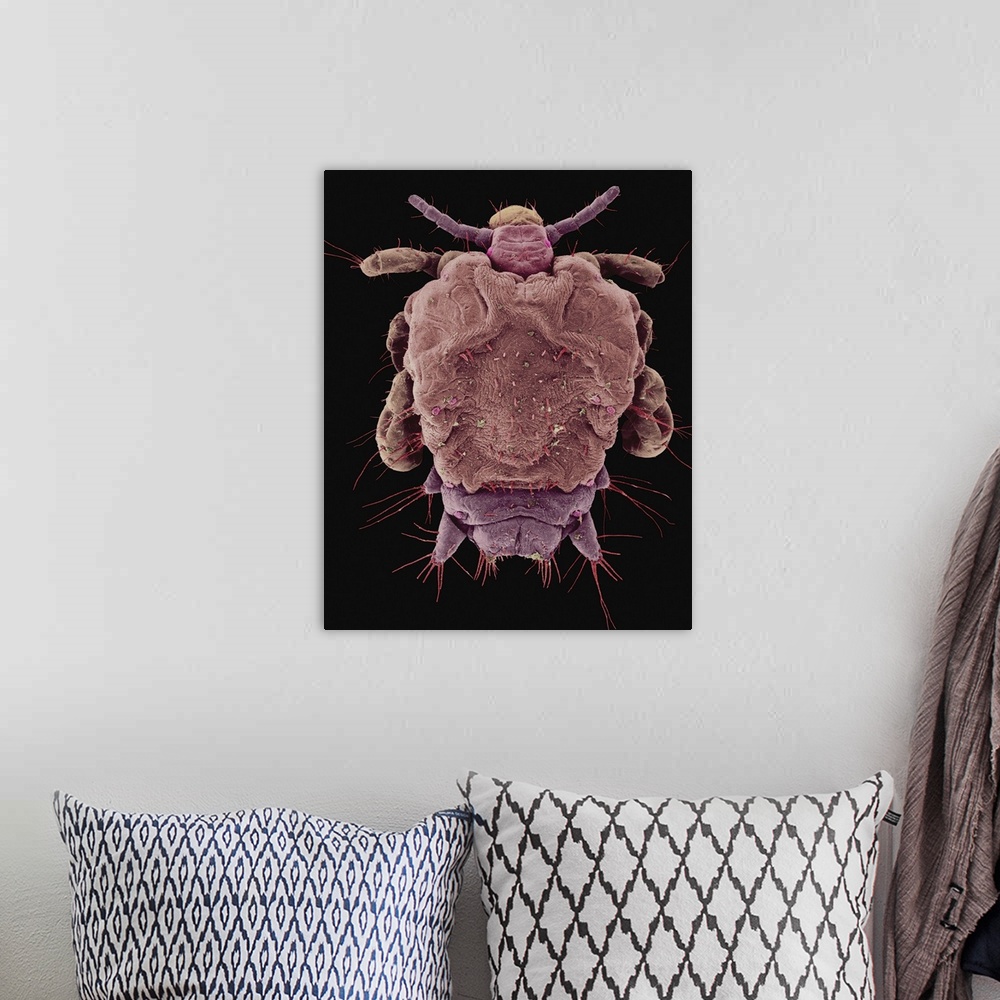 A bohemian room featuring Coloured scanning electron micrograph (SEM) of Pubic louse -Pthirus pubis. The pubic louse (also ...