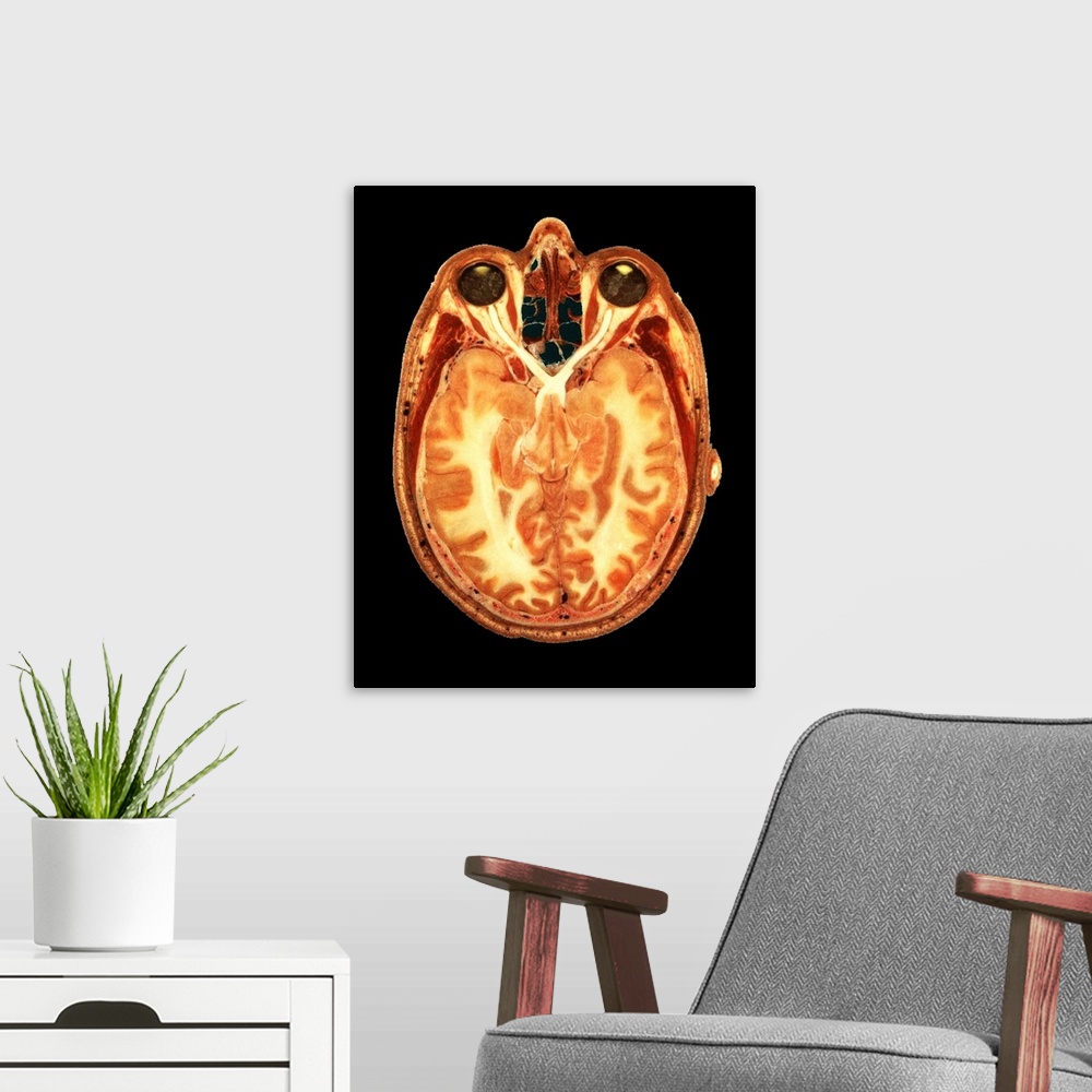 A modern room featuring Section through a human head. Axial (transverse) slice through the healthy human head of a male, ...