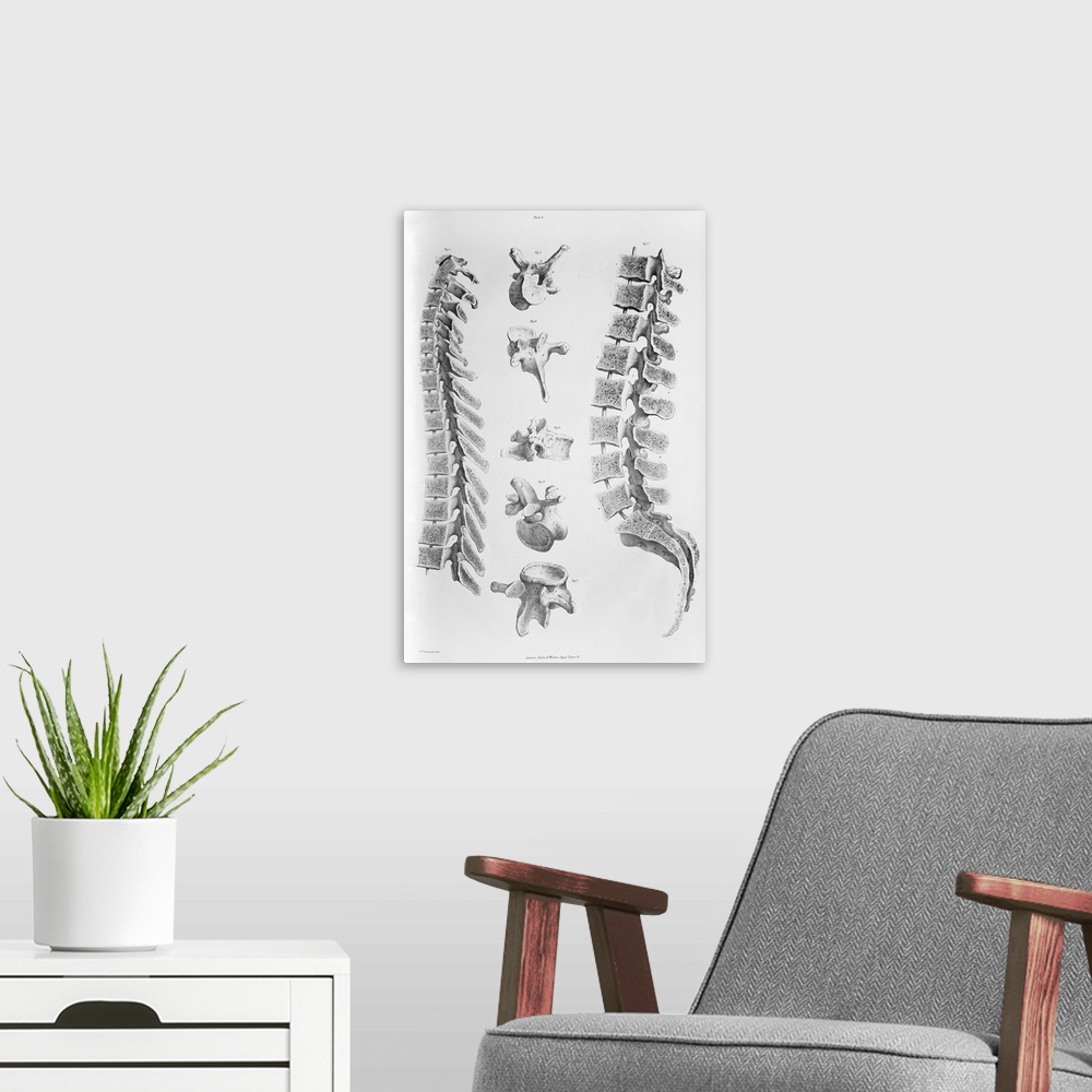 A modern room featuring Spine anatomy. Historical anatomical artwork of a section through the spine (backbone) seen from ...