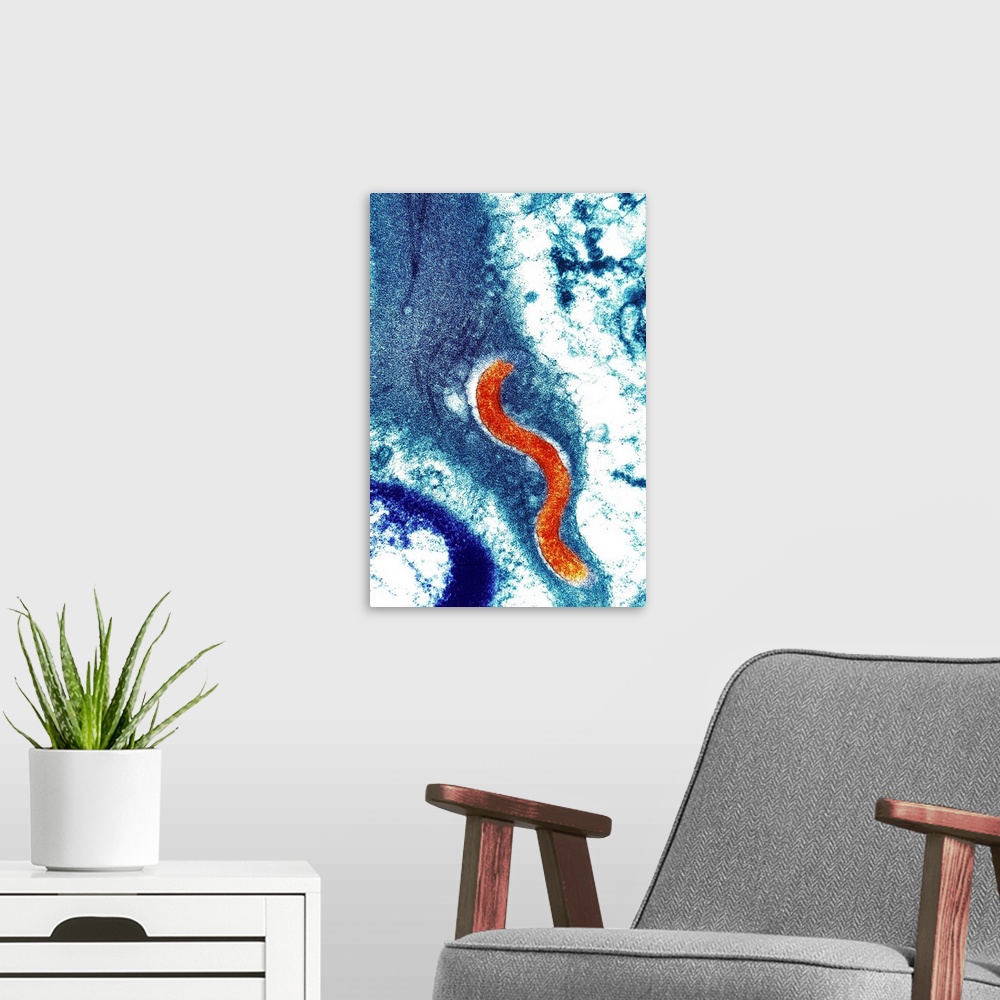 A modern room featuring Syphilis bacterium (Treponema pallidum). Coloured transmission electron micrograph (TEM) showing ...