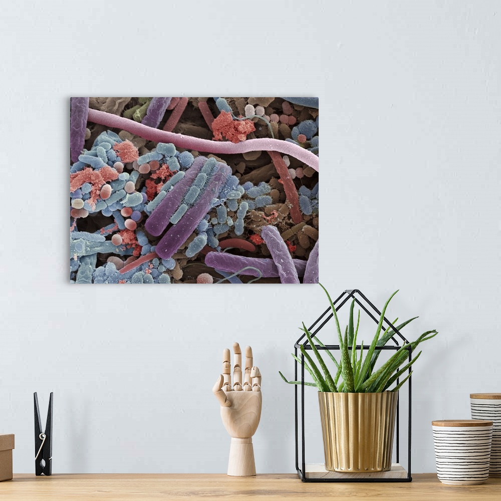 A bohemian room featuring Tongue bacteria. Coloured scanning electron micrograph (SEM) of bacteria on the surface of a huma...
